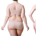 Exploring the Potential Impact of Liposuction on Breast Size and Shape