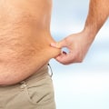 Explanation of Liposuction: A Comprehensive Guide for Men and Women