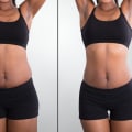 Understanding Non-Surgical Liposuction: Before and After Photos