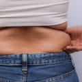 Liposuction for a Leaner Appearance: Removing Love Handles and Belly Fat