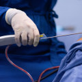 Understanding Different Types of Anesthesia for Liposuction