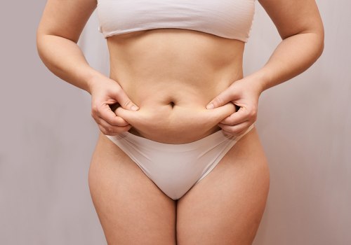 Managing Pain and Discomfort During Liposuction Recovery