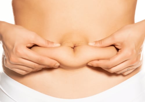 Exploring Abdomen and Waist Liposuction for a Flatter Stomach