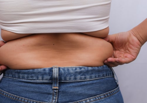 Liposuction for a Leaner Appearance: Removing Love Handles and Belly Fat