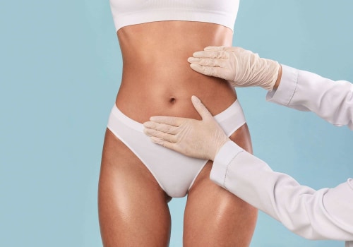 Everything You Need to Know About Cryolipolysis (CoolSculpting)