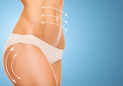 Understanding the Potential Risks and Complications of Liposuction